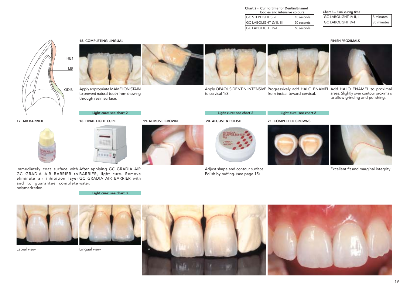 GC EUROPE GRADIA User Manual | Page 21 / 36