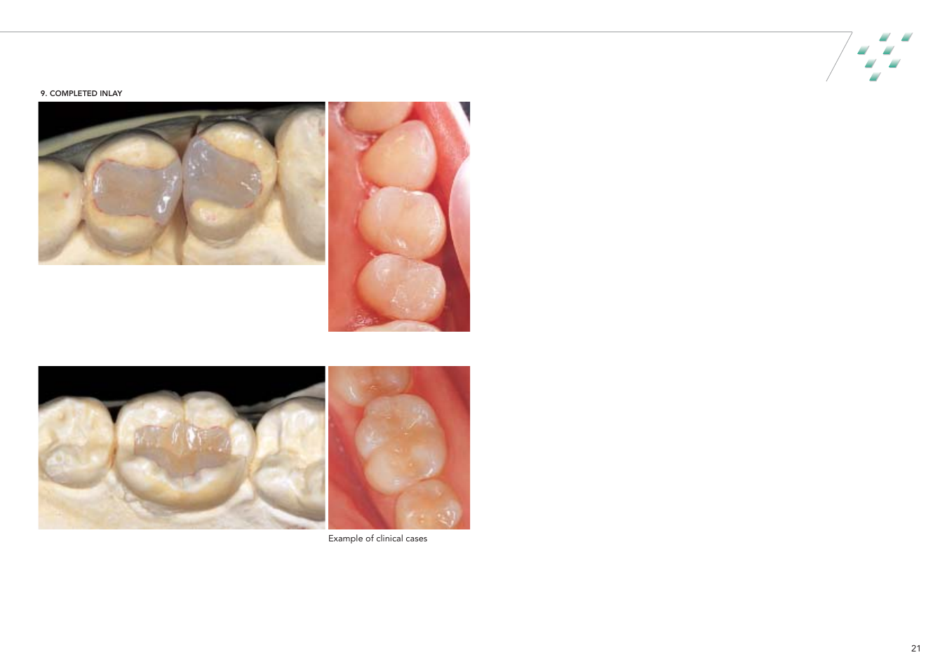 GC EUROPE GRADIA User Manual | Page 23 / 36