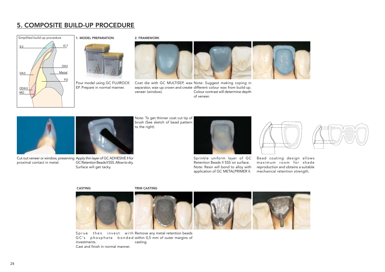 Composite build-up procedure | GC EUROPE GRADIA User Manual | Page 26 / 36