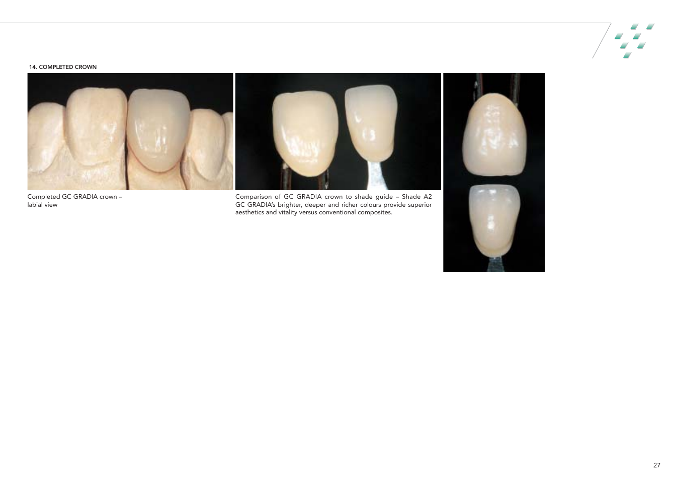 GC EUROPE GRADIA User Manual | Page 29 / 36