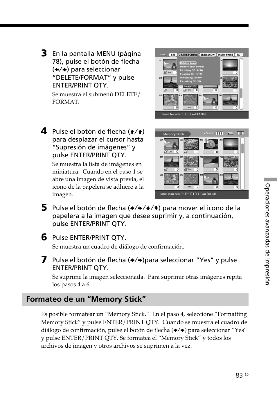 Formateo de un “memory stick | Sony DPP-SV88 User Manual | Page 311 / 344