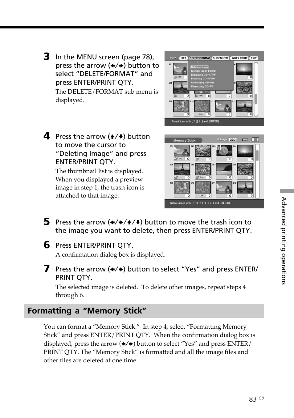 Formatting a “memory stick, Memory stick | Sony DPP-SV88 User Manual | Page 83 / 344