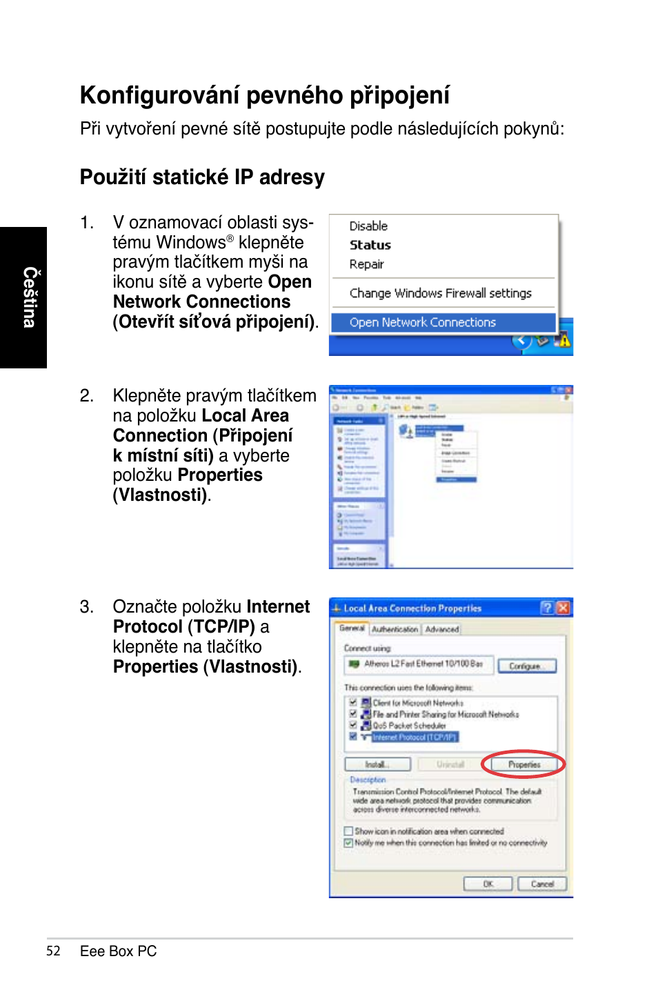 Konfigurování pevného připojení, Použití statické ip adresy | Asus B202 User Manual | Page 52 / 128