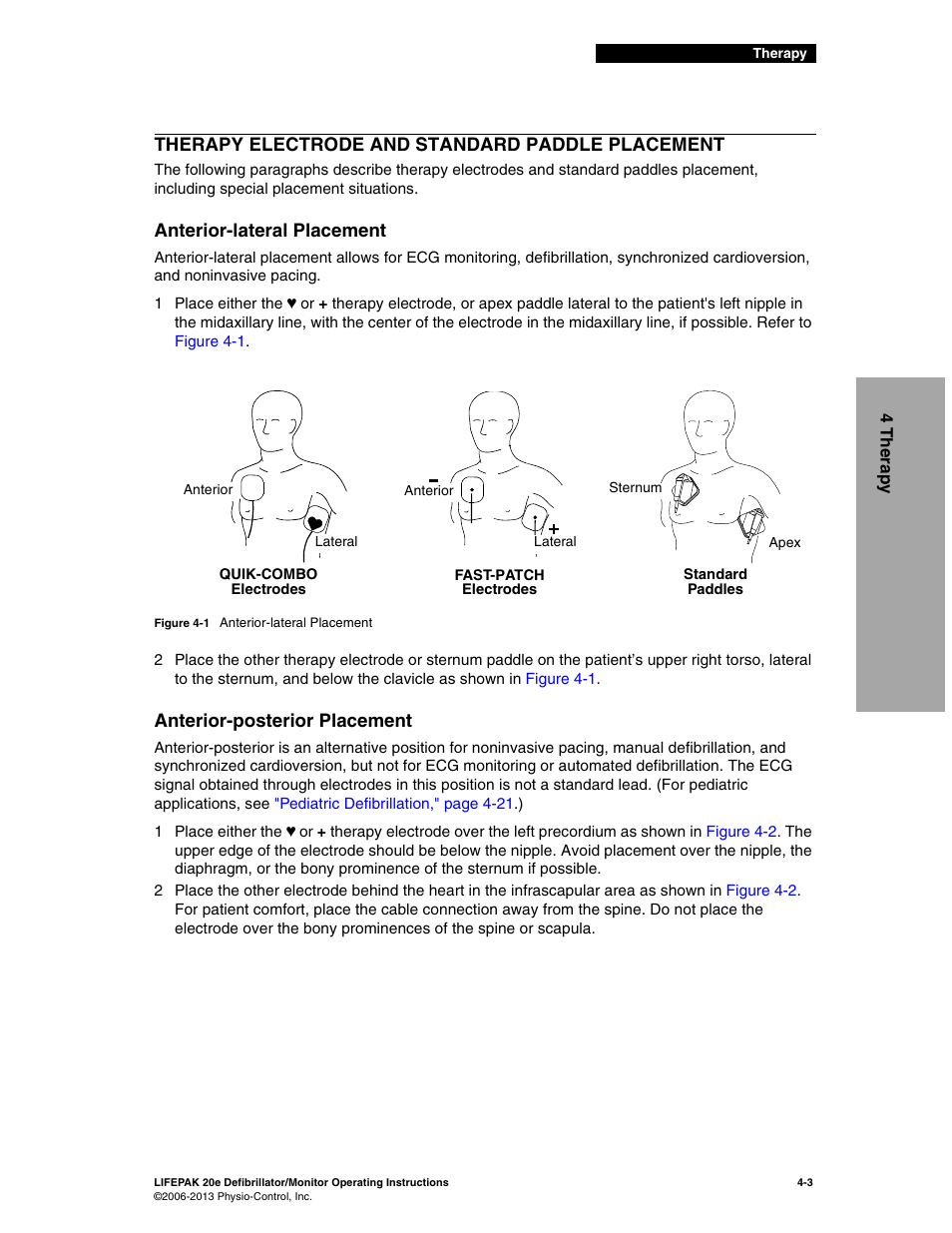 Therapy electrode and standard paddle placement, Anterior-lateral placement, Anterior-posterior placement | Therapy electrode and standard paddle placement -3 | Physio-Control LIFEPAK 20e User Manual | Page 73 / 218