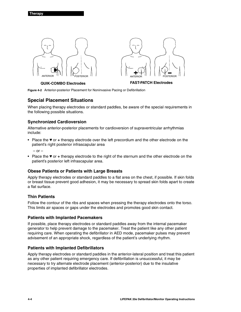 Special placement situations, Special placement situations -4, Figure 4-2 | Physio-Control LIFEPAK 20e User Manual | Page 74 / 218