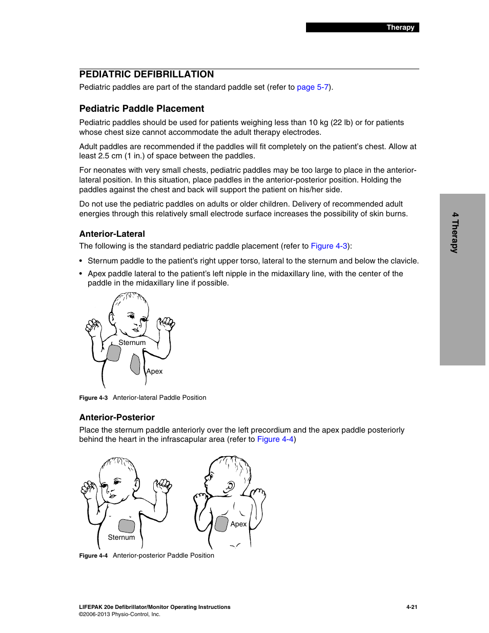 Pediatric defibrillation, Pediatric paddle placement, Pediatric defibrillation -21 | Pediatric paddle placement -21 | Physio-Control LIFEPAK 20e User Manual | Page 91 / 218