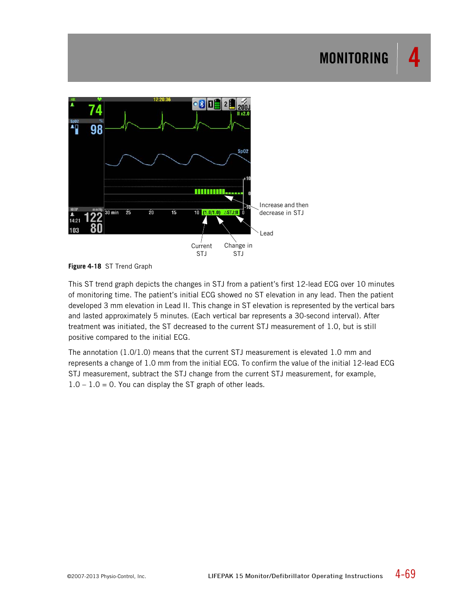 Monitoring | Physio-Control LIFEPAK 15 User Manual | Page 113 / 290