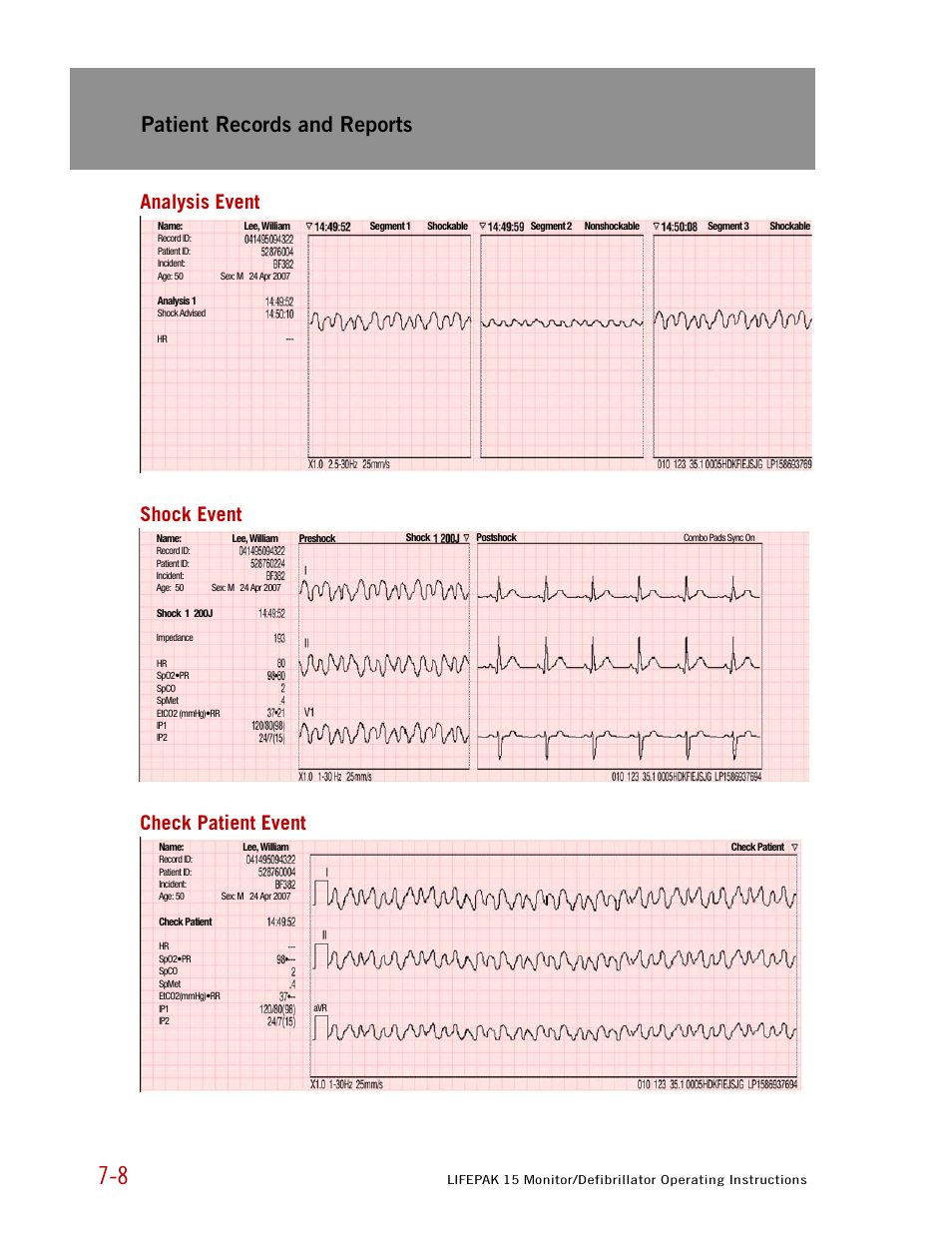 Analysis event, Shock event, Check patient event | Patient records and reports, Analysis event shock event check patient event | Physio-Control LIFEPAK 15 User Manual | Page 172 / 290