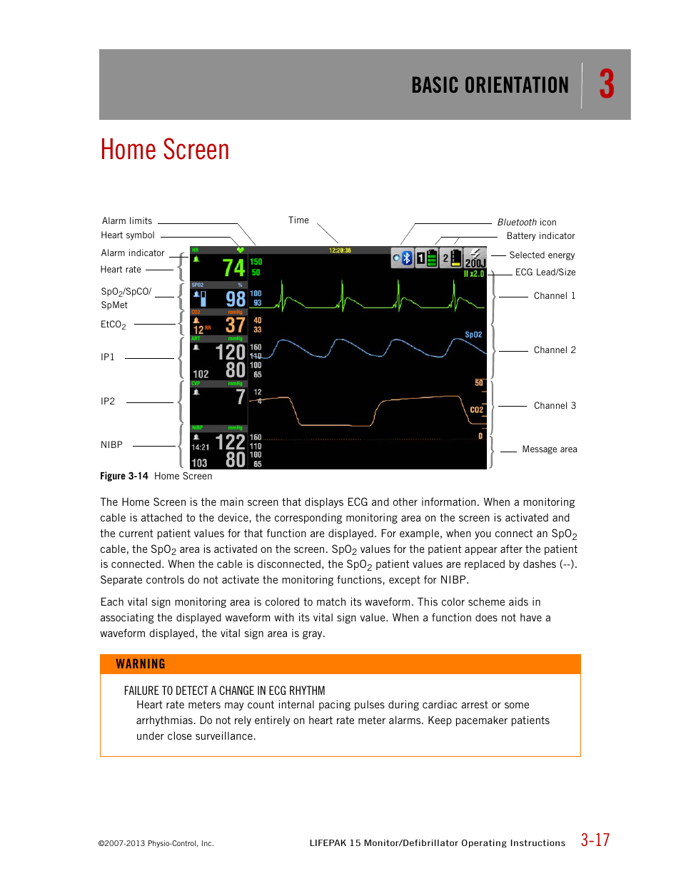 Home screen, Basic orientation, Warning | Physio-Control LIFEPAK 15 User Manual | Page 35 / 290