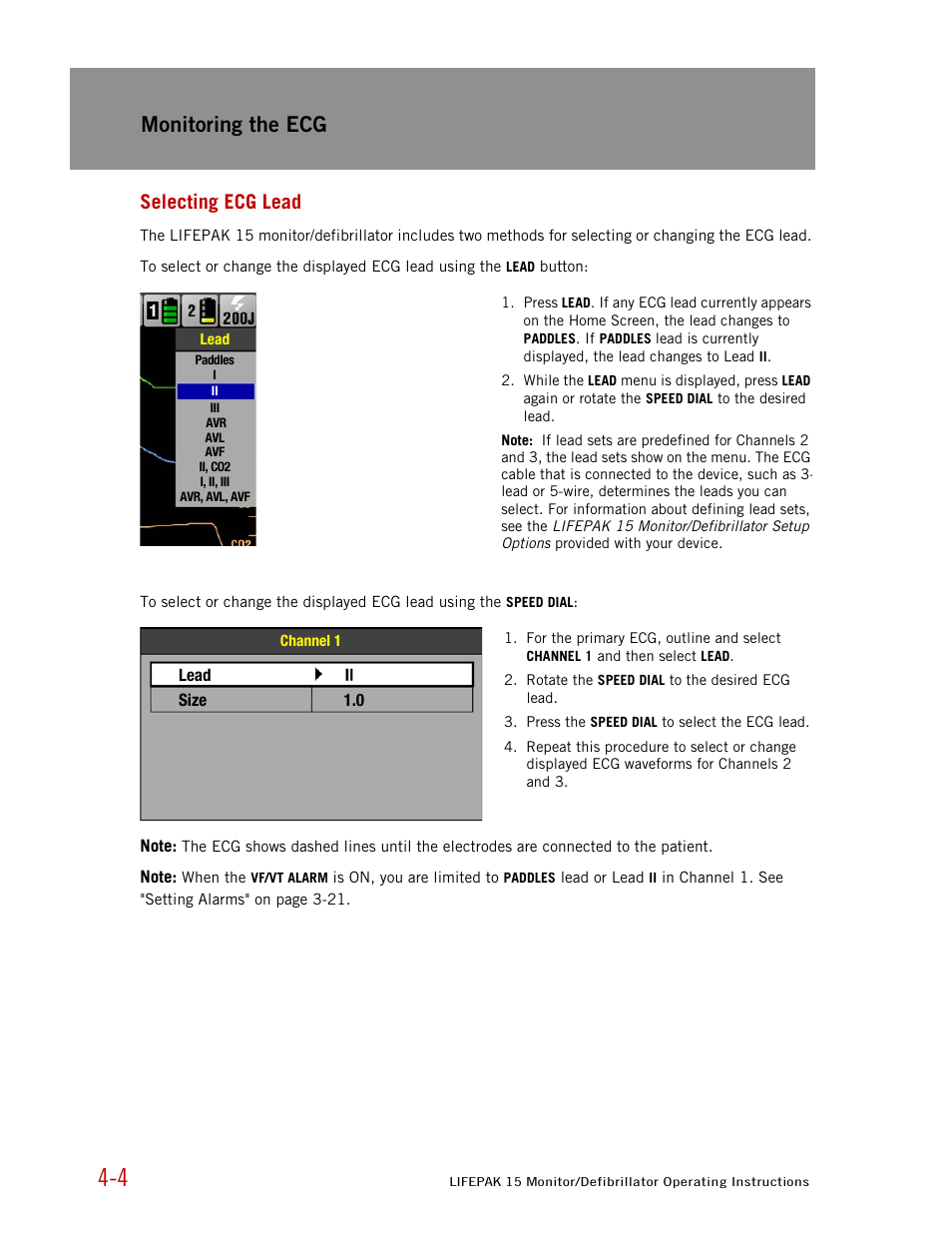 Selecting ecg lead, Monitoring the ecg | Physio-Control LIFEPAK 15 User Manual | Page 48 / 290