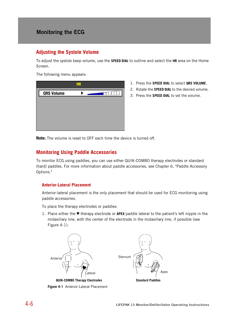 Adjusting the systole volume, Monitoring using paddle accessories, Anterior-lateral placement | Monitoring the ecg | Physio-Control LIFEPAK 15 User Manual | Page 50 / 290