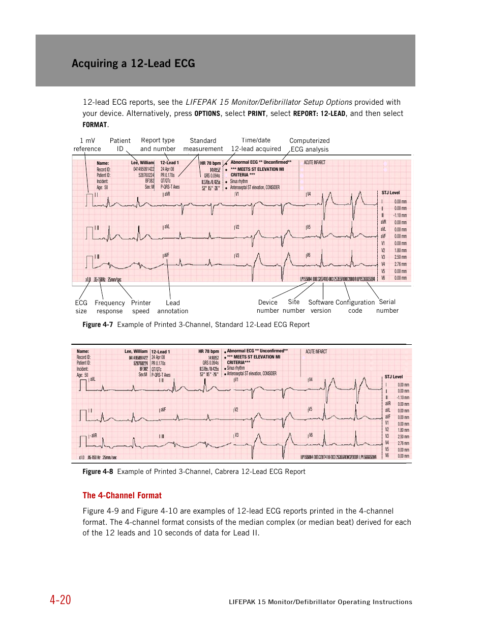 The 4-channel format, Acquiring a 12-lead ecg | Physio-Control LIFEPAK 15 User Manual | Page 64 / 290