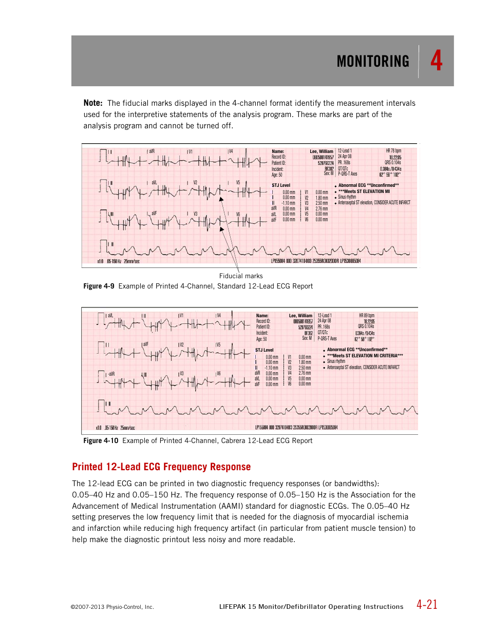Printed 12-lead ecg frequency response, Monitoring | Physio-Control LIFEPAK 15 User Manual | Page 65 / 290