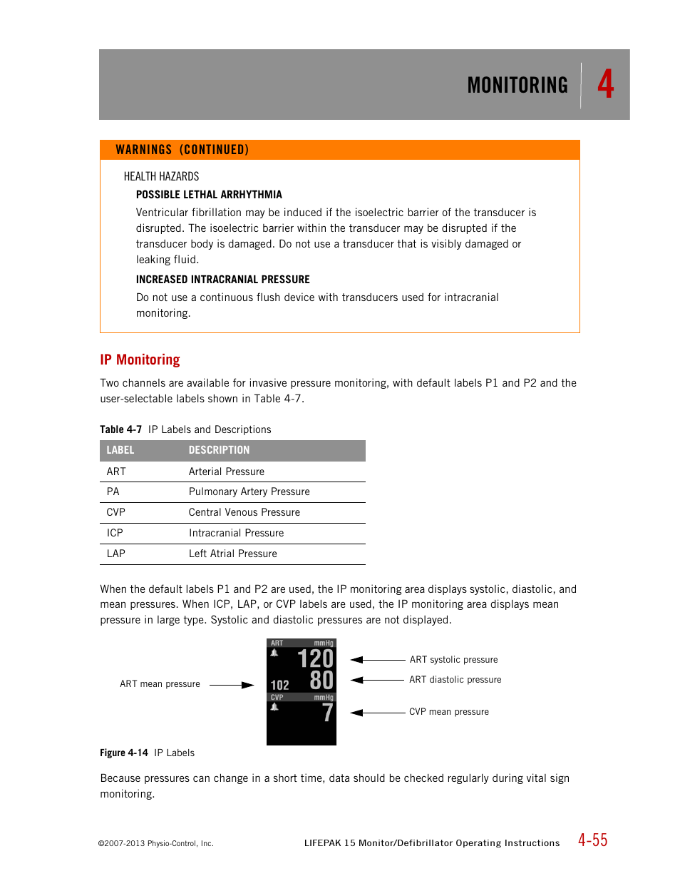 Ip monitoring, Monitoring | Physio-Control LIFEPAK 15 User Manual | Page 99 / 290