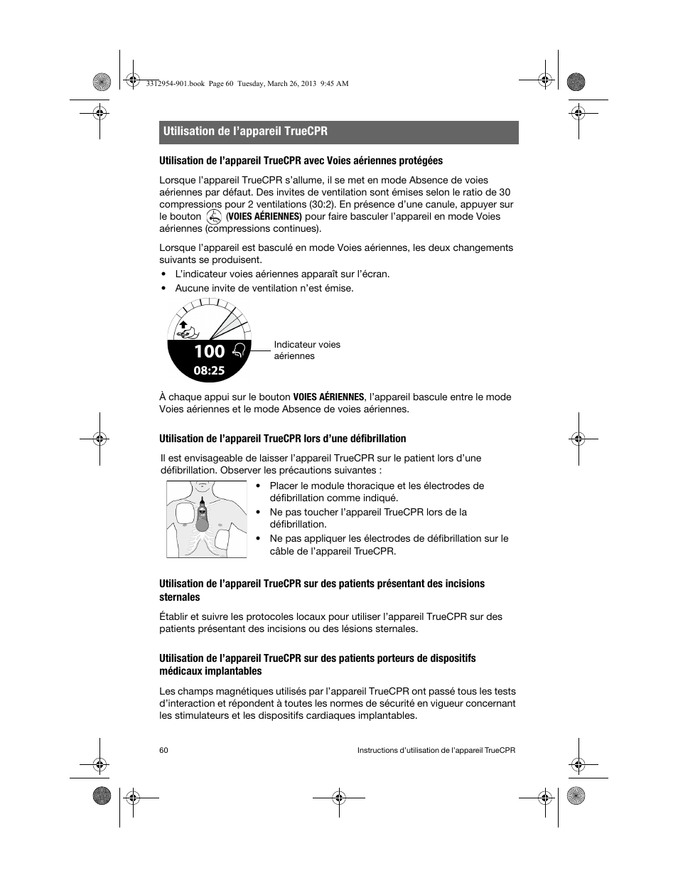 Physio-Control TrueCPR User Manual | Page 64 / 84