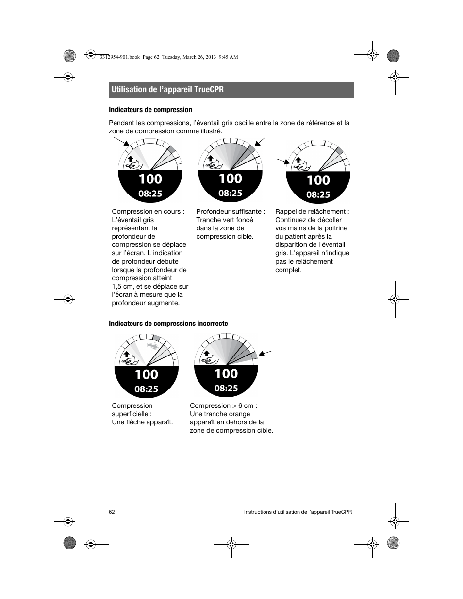 Indicateurs de compression, Indicateurs de compressions incorrecte, Utilisation de l’appareil truecpr | Physio-Control TrueCPR User Manual | Page 66 / 84