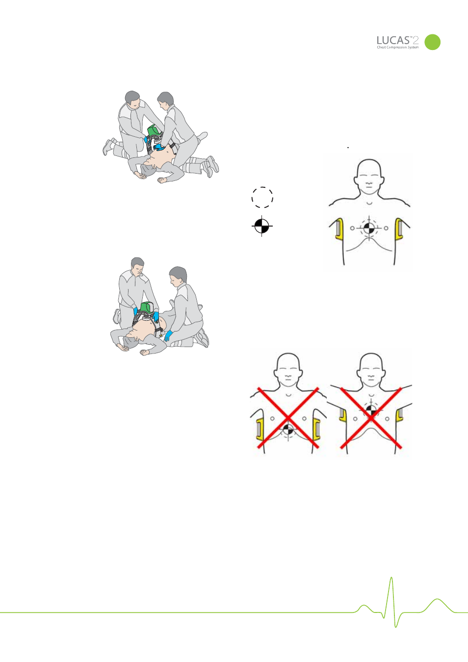 Physio-Control LUCAS 2 User Manual | Page 17 / 40