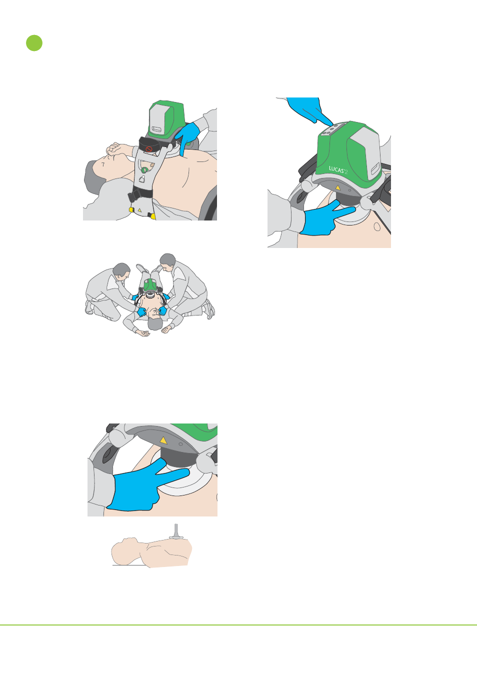 Physio-Control LUCAS 2 User Manual | Page 18 / 40