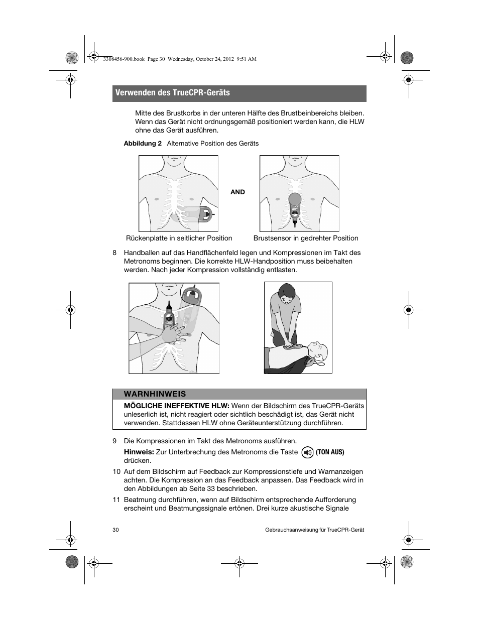 Verwenden des truecpr-geräts | Physio-Control TrueCPR User Manual | Page 36 / 106