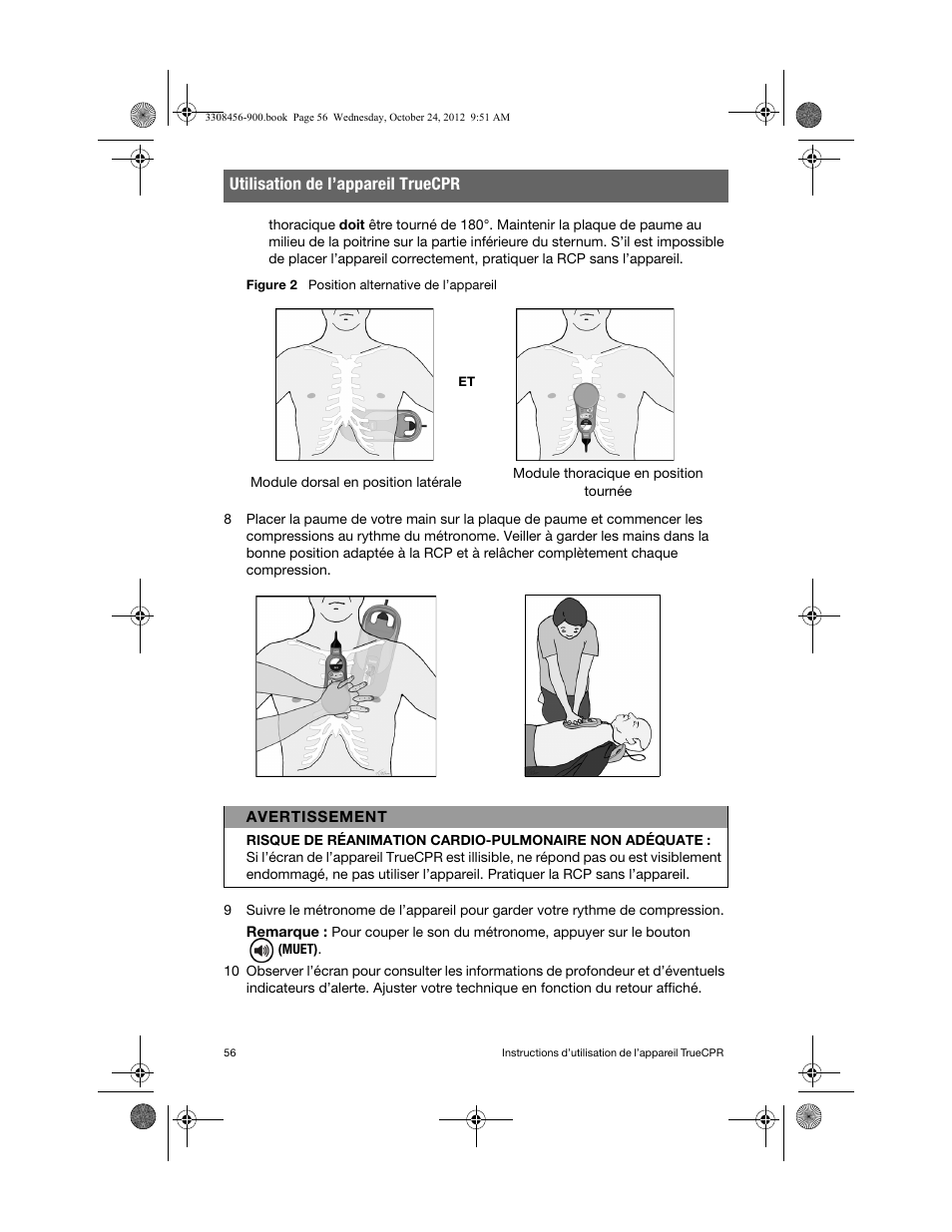 Utilisation de l’appareil truecpr | Physio-Control TrueCPR User Manual | Page 62 / 106