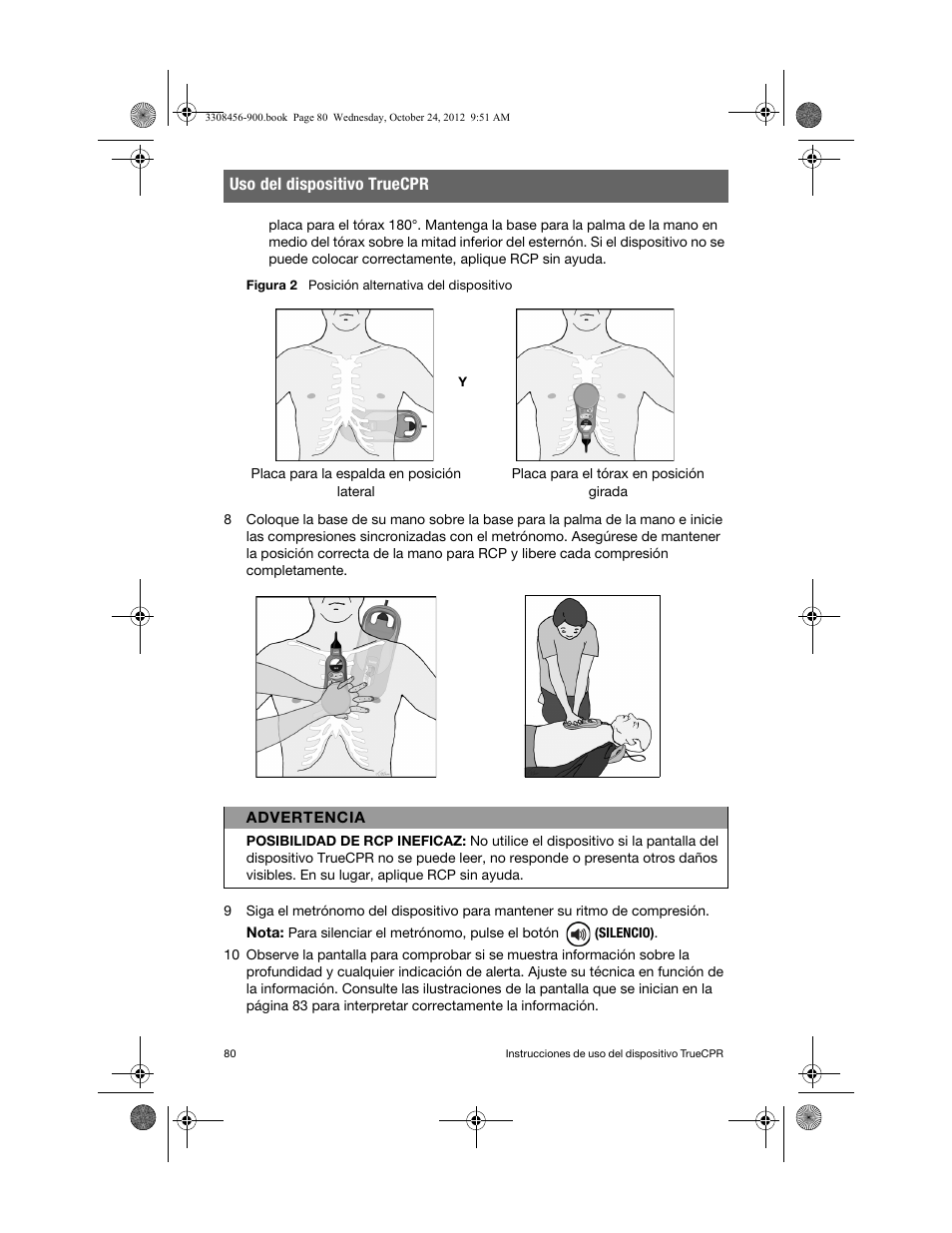 Uso del dispositivo truecpr | Physio-Control TrueCPR User Manual | Page 86 / 106