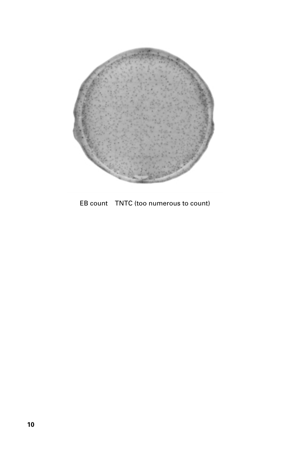 Carolina 3M Petrifilm Enterobacteriaceae Count Plates User Manual | Page 10 / 12