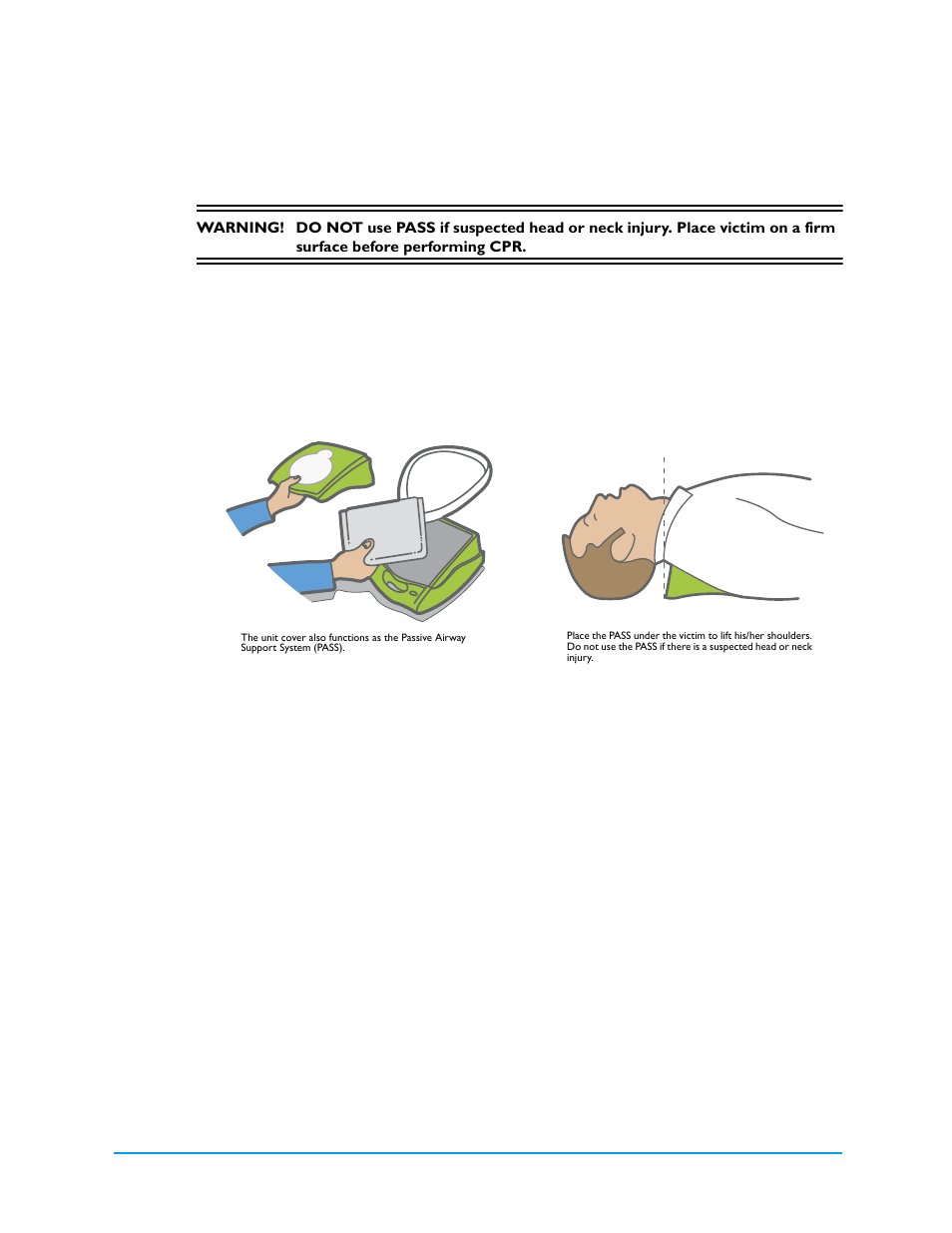 Using the passive airway support system (pass) | ZOLL AED Plus Rev V User Manual | Page 20 / 54