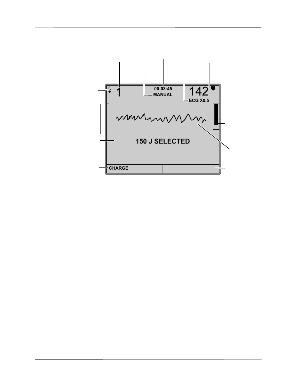 150 j selected | ZOLL AED Pro Rev J User Manual | Page 31 / 118