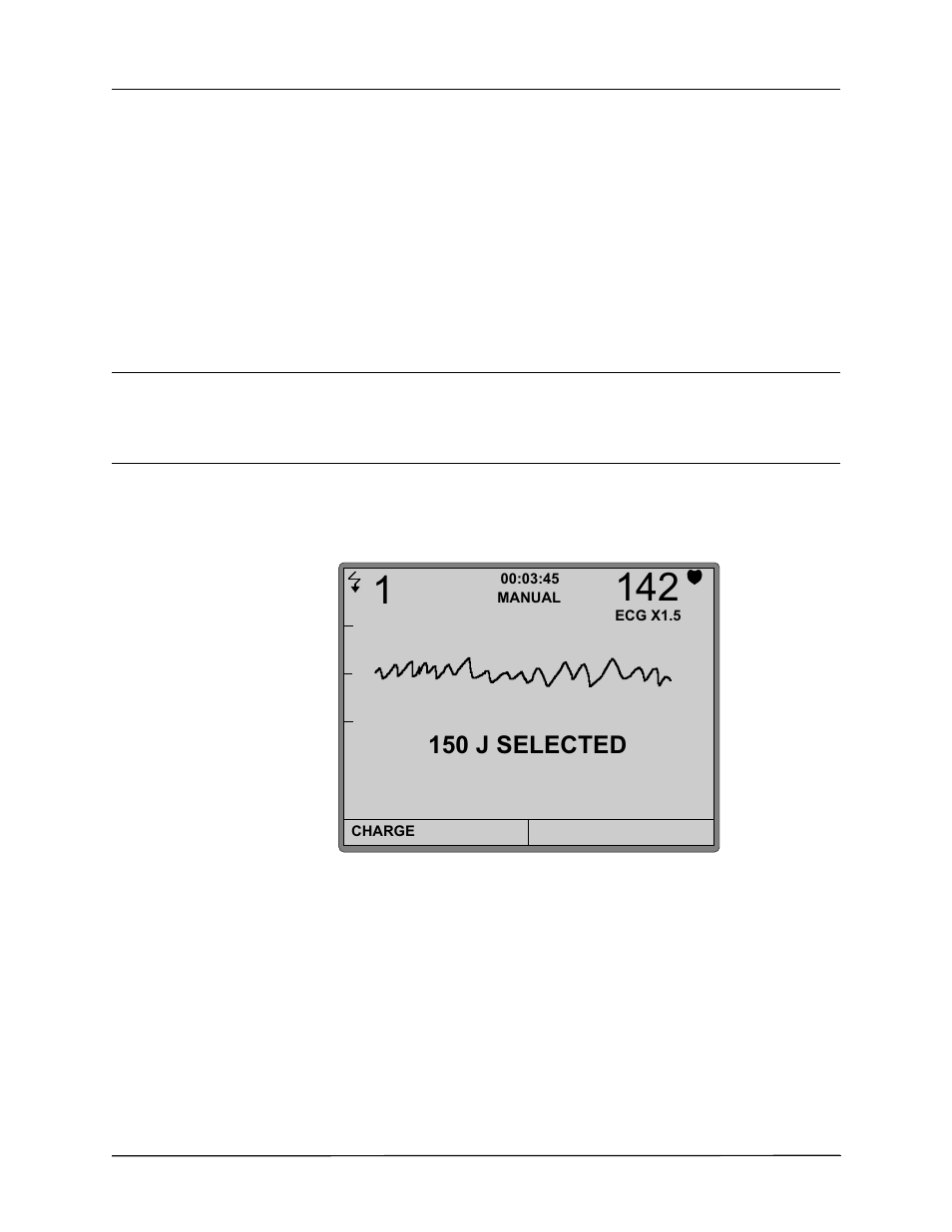 About manual mode, 150 j selected | ZOLL AED Pro Rev J User Manual | Page 56 / 118