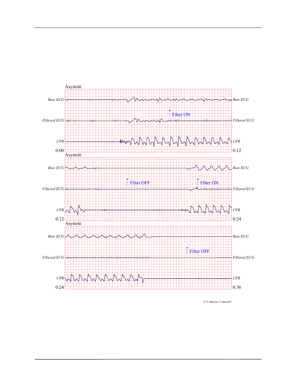 ZOLL AED Pro Rev J User Manual | Page 62 / 118