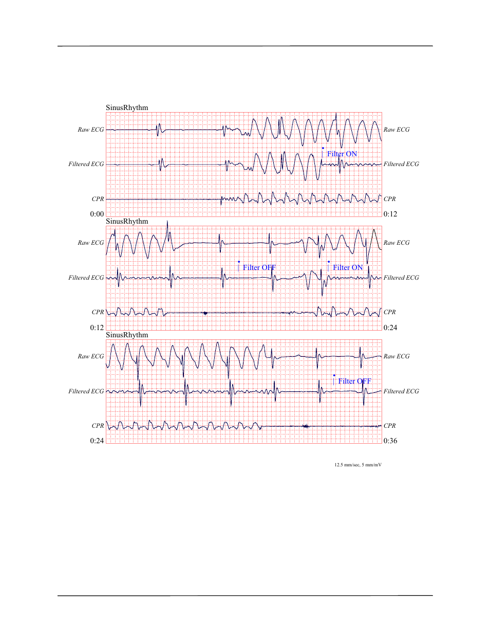 ZOLL AED Pro Rev J User Manual | Page 63 / 118