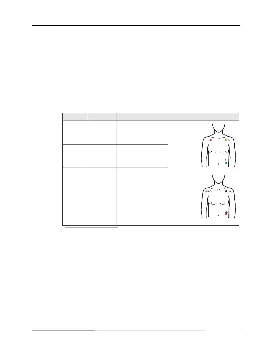 Ecg electrode placement | ZOLL AED Pro Rev J User Manual | Page 67 / 118