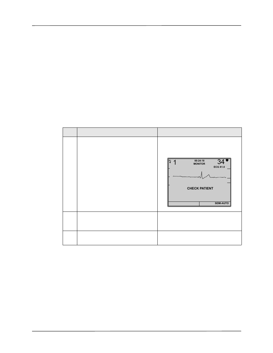 Monitoring with defibrillation electrodes | ZOLL AED Pro Rev J User Manual | Page 71 / 118