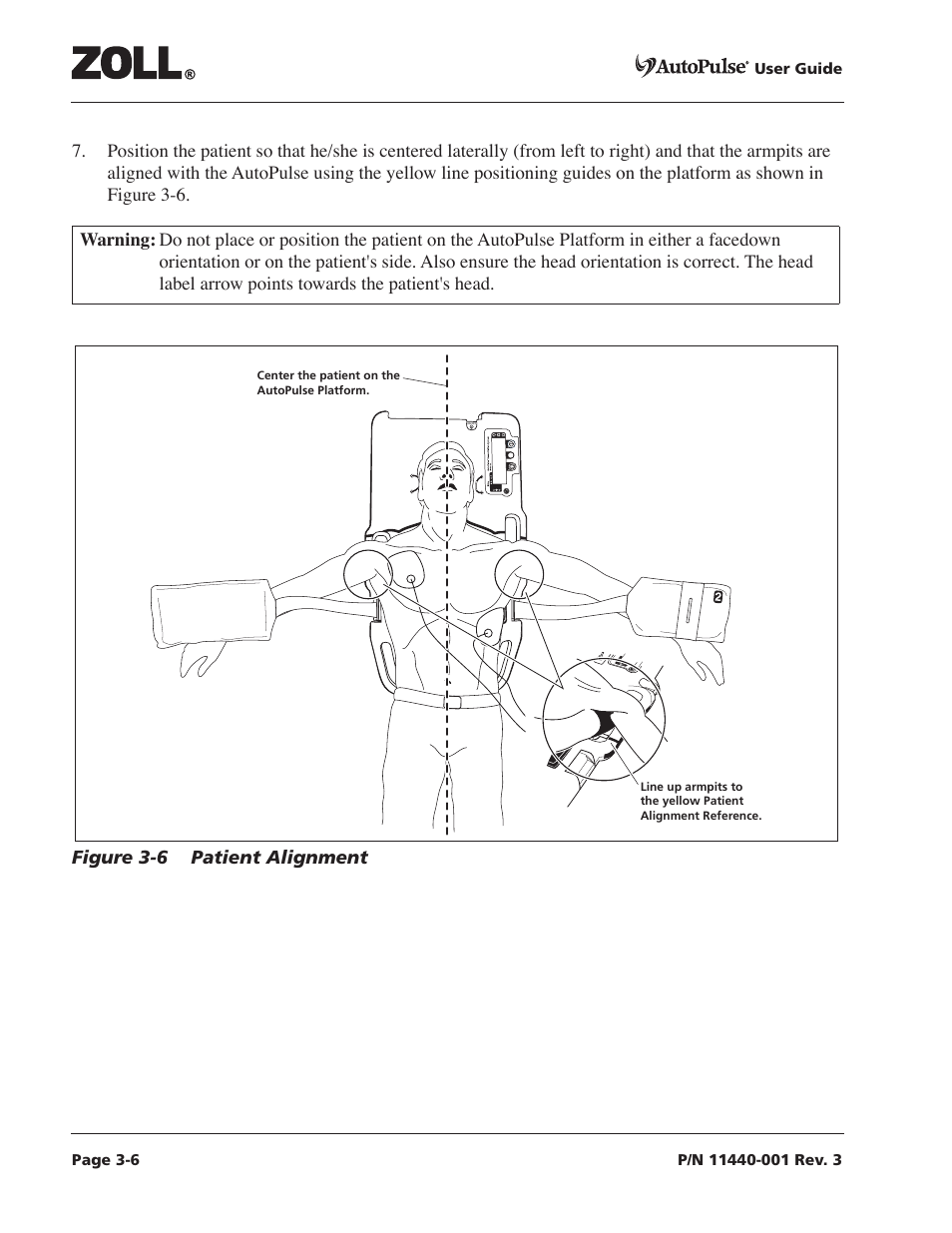 Figure 3-6 patient alignment -6 | ZOLL AutoPulse Rev D Users Guide User Manual | Page 44 / 86