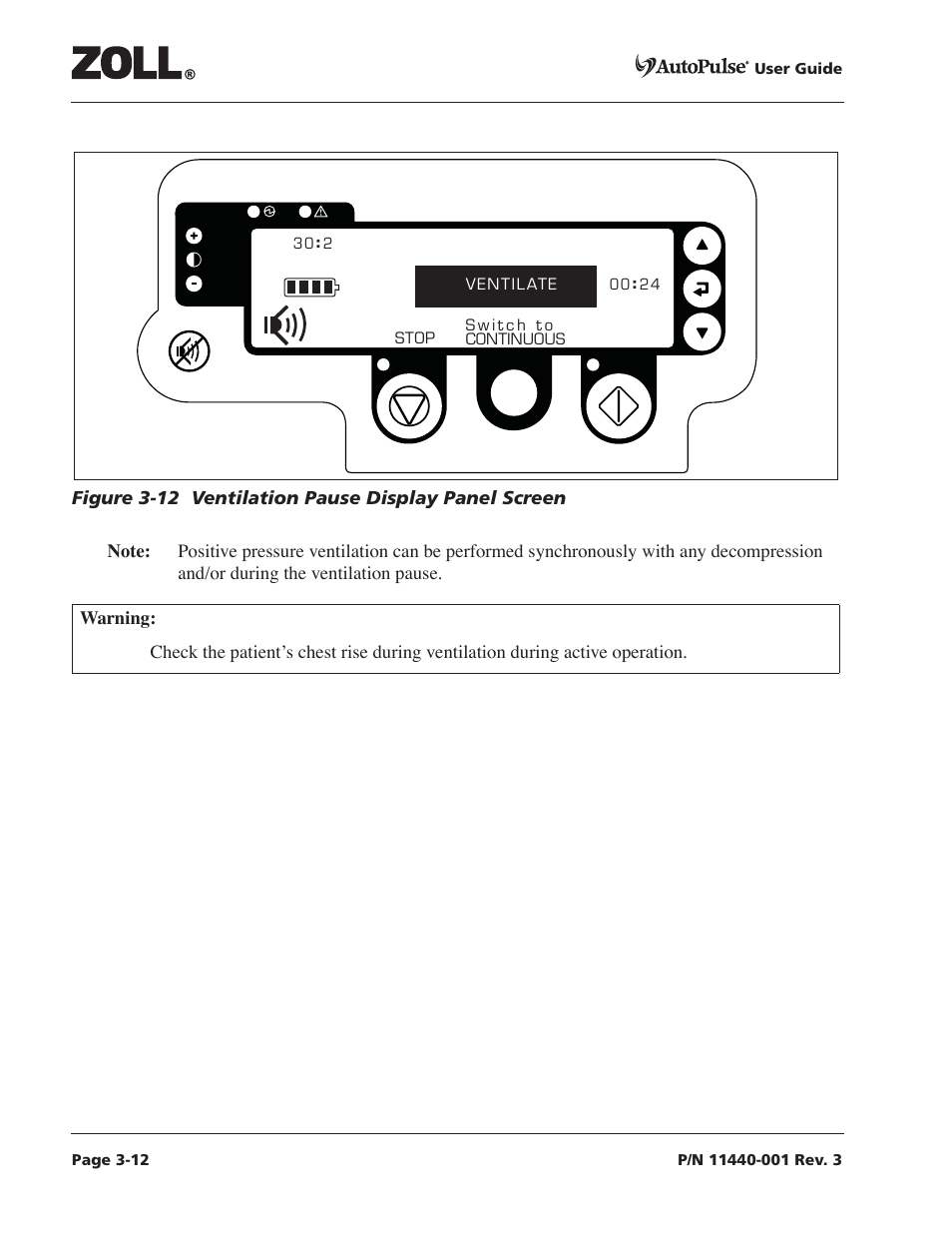 ZOLL AutoPulse Rev D Users Guide User Manual | Page 50 / 86