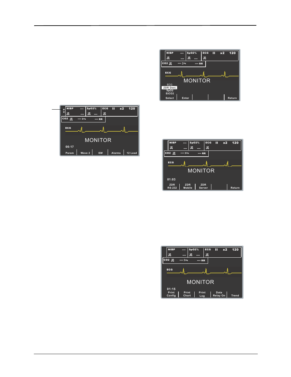 Activating automatic data transmission, Monitor | ZOLL E Series Monitor Defibrillator Rev R User Manual | Page 130 / 132