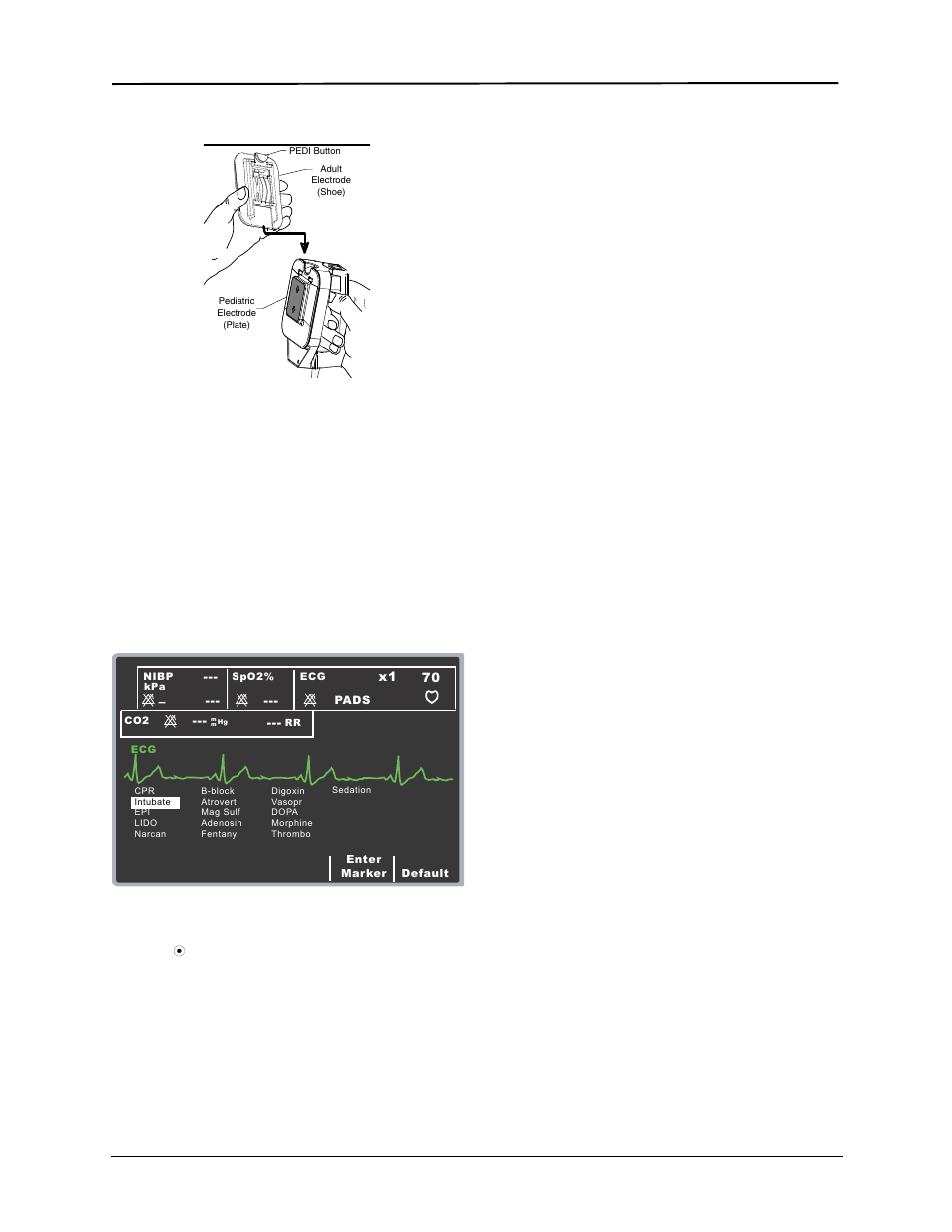 Code markers, Summary report function | ZOLL E Series Monitor Defibrillator Rev R User Manual | Page 28 / 132