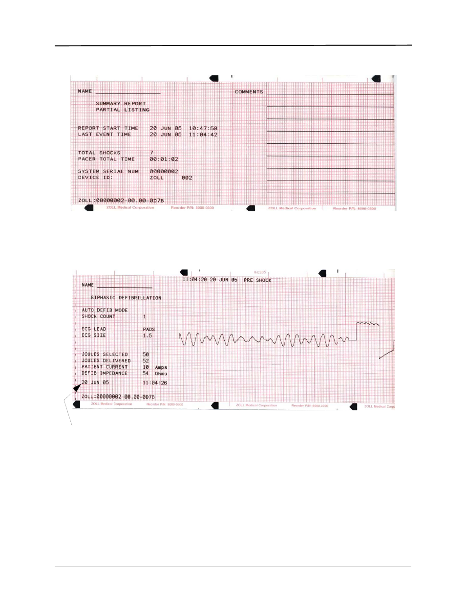 ZOLL E Series Monitor Defibrillator Rev R User Manual | Page 29 / 132