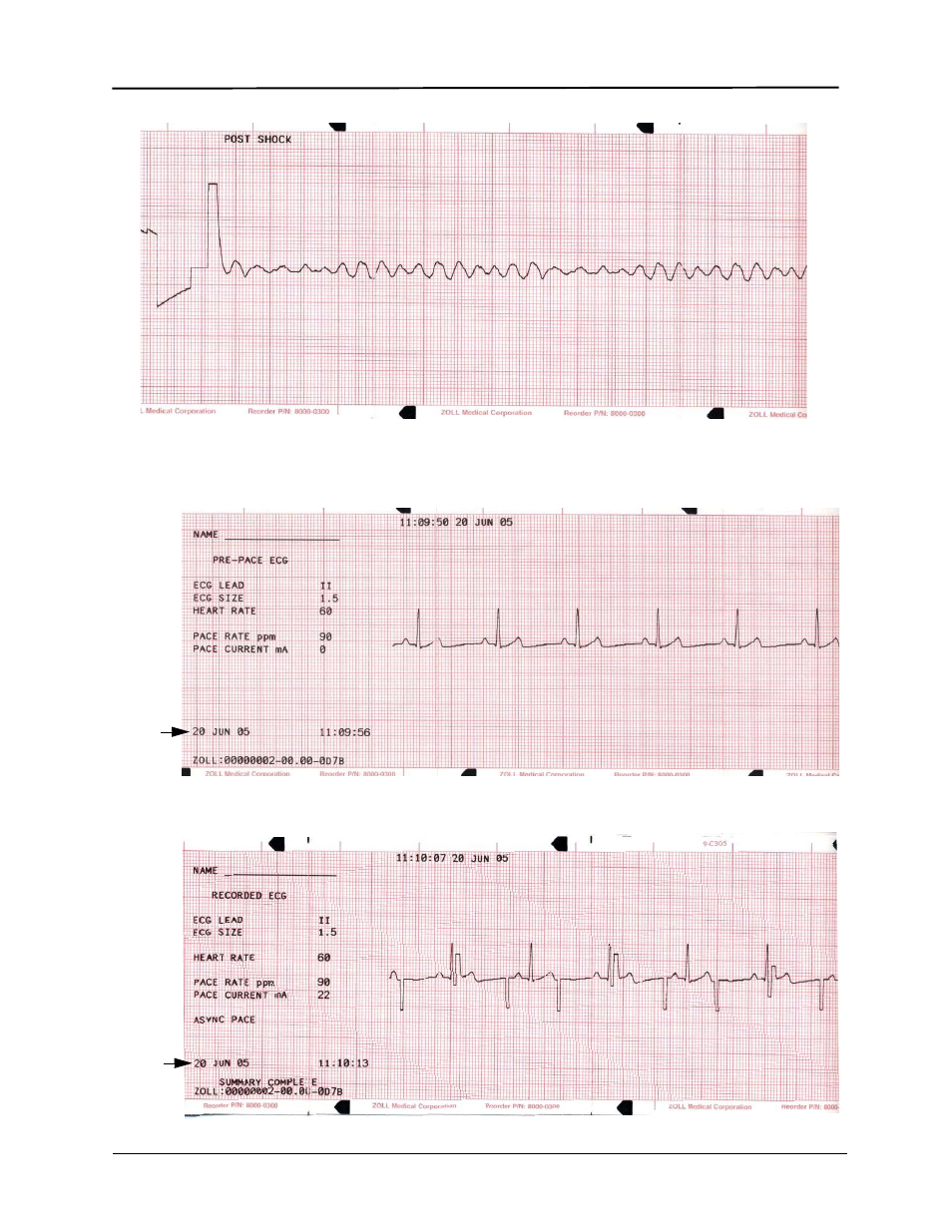 ZOLL E Series Monitor Defibrillator Rev R User Manual | Page 30 / 132