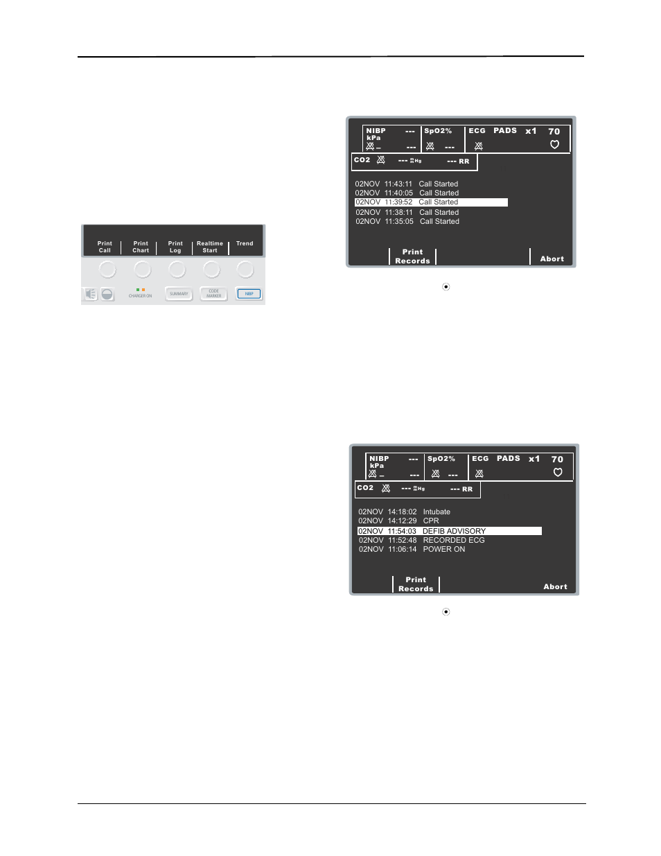 Printing a report, Printing a call report, Printing a partial summary report | Printing an incident log, Operating controls and indicators, Manual mode activated | ZOLL E Series Monitor Defibrillator Rev R User Manual | Page 33 / 132