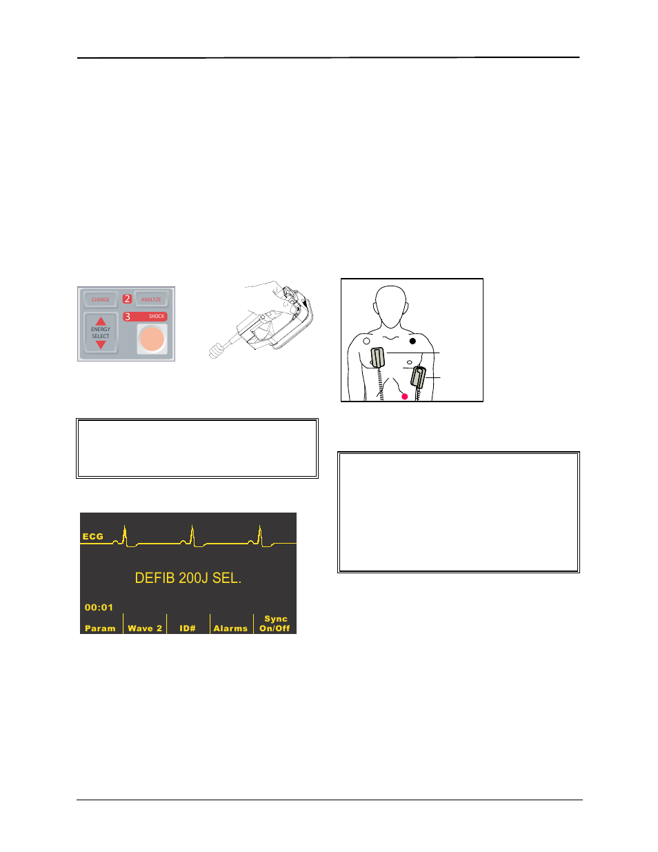 Defib 200j sel, Warning | ZOLL E Series Monitor Defibrillator Rev R User Manual | Page 38 / 132