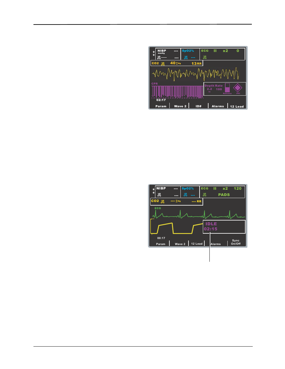 Cpr dashboard, Real cpr help, Displaying the cpr compressions bar graph | Cpr feedback indicators and cpr index, Cpr rate and depth display, Cpr idle time display | ZOLL E Series Monitor Defibrillator Rev R User Manual | Page 59 / 132