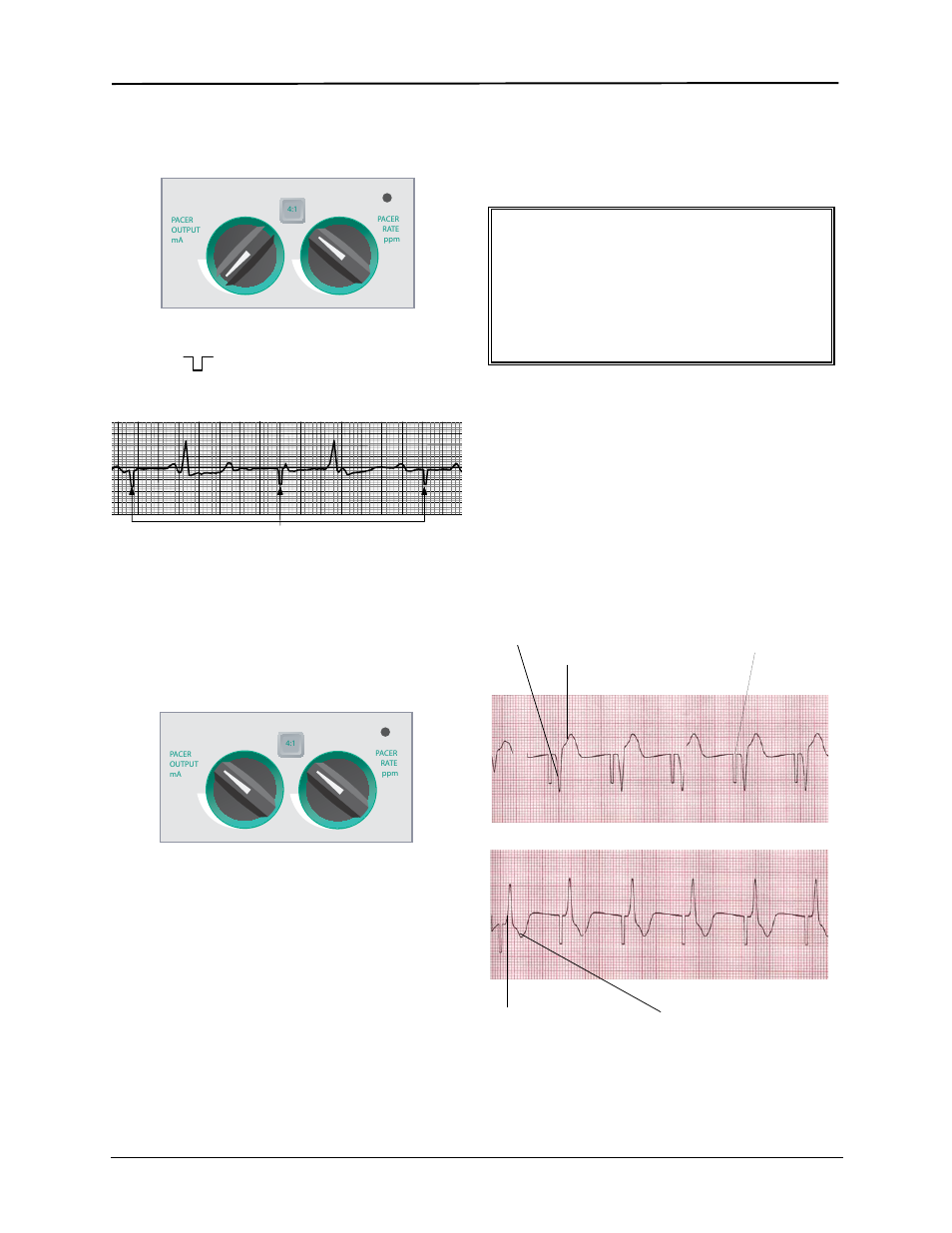 Warning | ZOLL E Series Monitor Defibrillator Rev R User Manual | Page 68 / 132