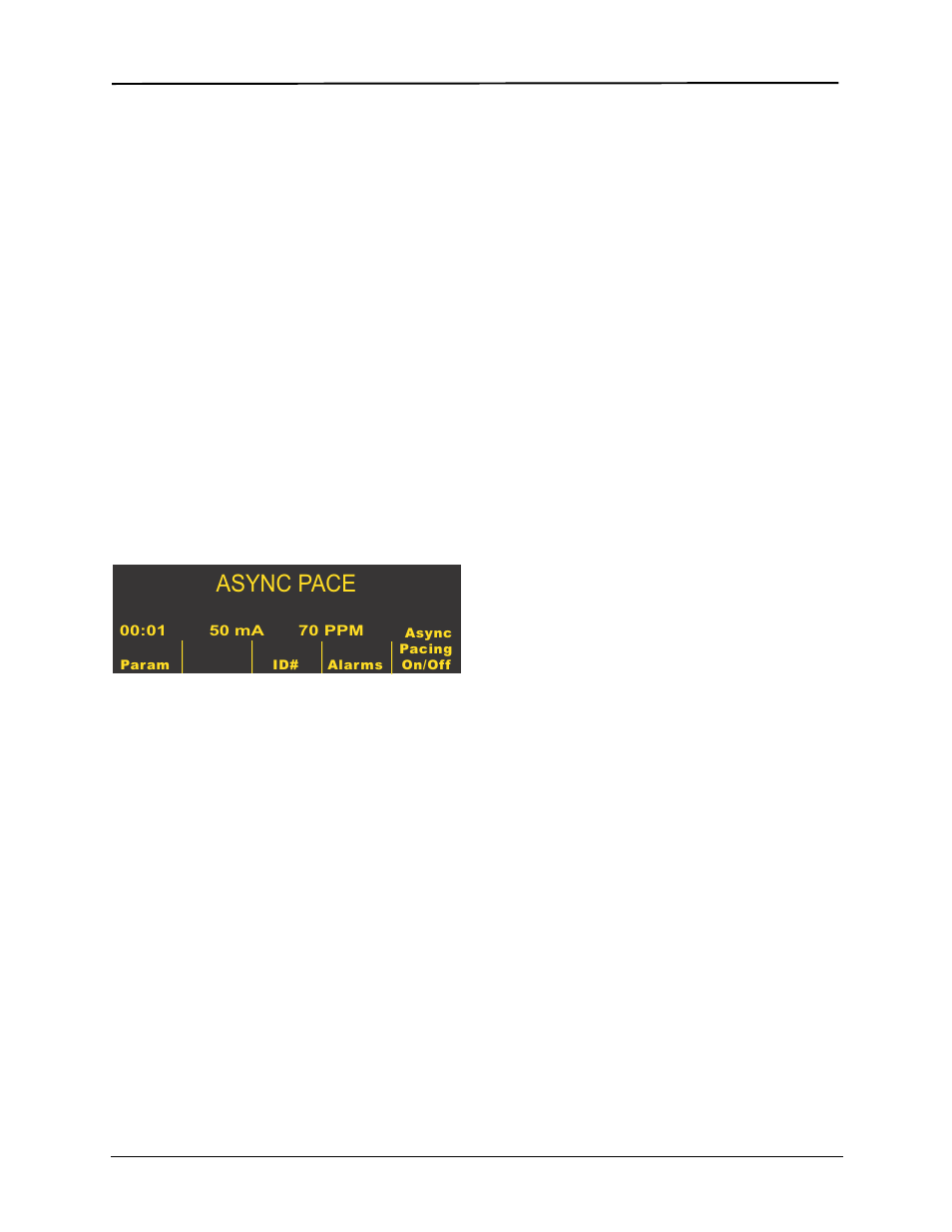 Async pace, Troubleshooting | ZOLL E Series Monitor Defibrillator Rev R User Manual | Page 70 / 132