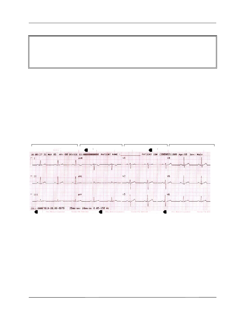 ZOLL E Series Monitor Defibrillator Rev G 12 Lead User Manual | Page 10 / 26