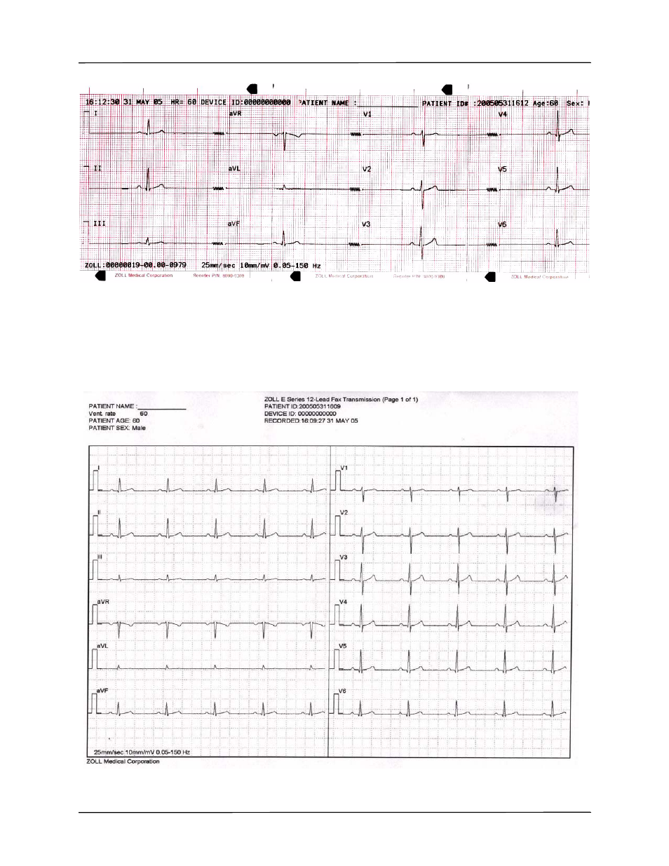 ZOLL E Series Monitor Defibrillator Rev G 12 Lead User Manual | Page 11 / 26