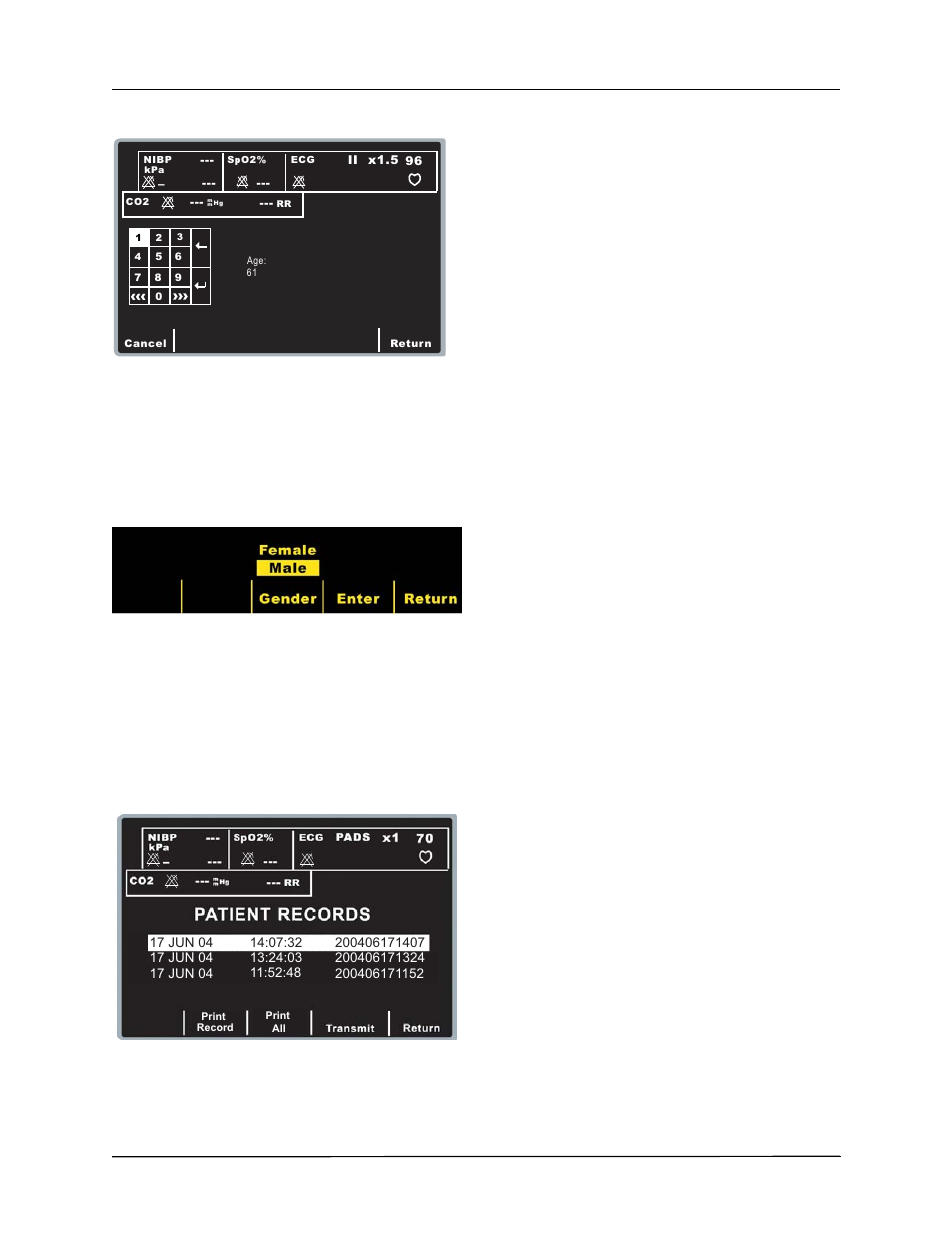 Lead reports | ZOLL E Series Monitor Defibrillator Rev G 12 Lead User Manual | Page 9 / 26