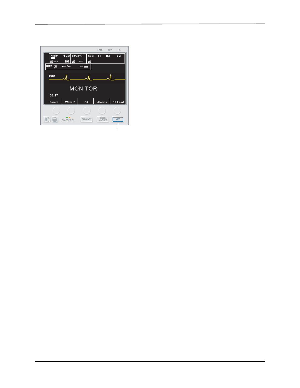 Printing data, Checkout procedure, Cleaning the hose and reusable cuffs | ZOLL E Series Monitor Defibrillator Rev G NIBP User Manual | Page 13 / 18