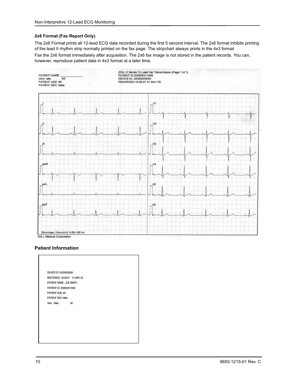 Patient information | ZOLL E Series Monitor Defibrillator Rev C User Manual | Page 12 / 20