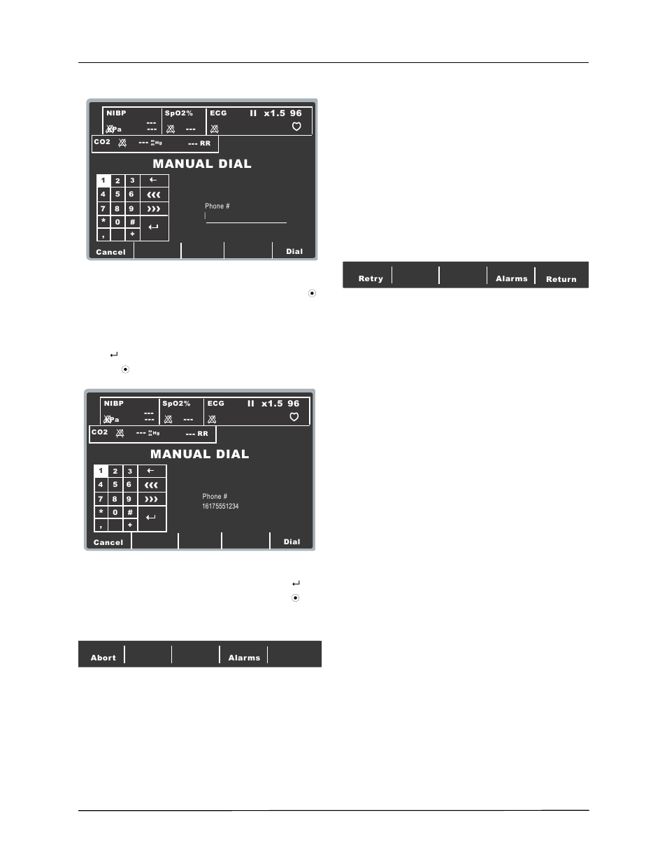 Manual dial | ZOLL E Series Monitor Defibrillator Rev B User Manual | Page 11 / 30